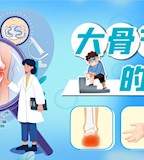 大骨节病的表现